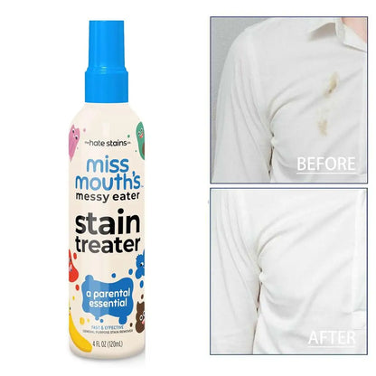 Laundry Stain Remover Anti Germ & Deodorization For Clothes 120/300ML  Fabric Upholstery Carpet Stain Spray Yellow Removal Bleach